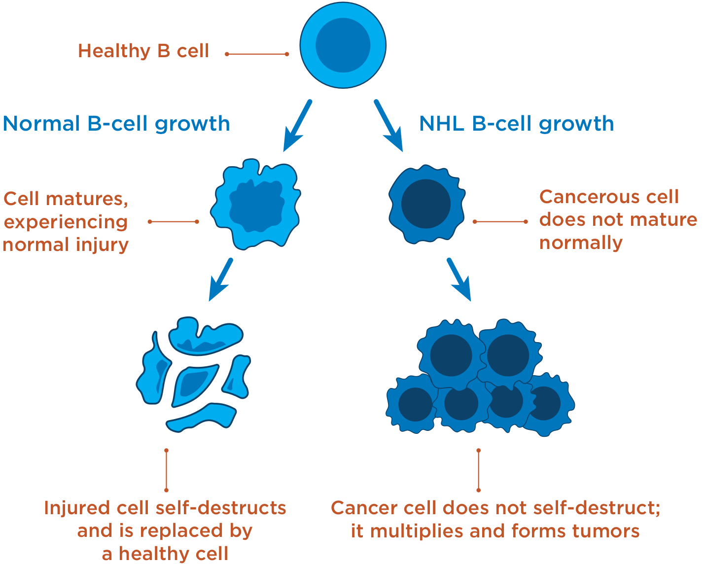 B-cell non-Hodgkin's lymphoma